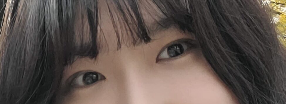 金洪振院长   自然粘连 术后反馈