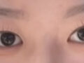 การผ่าตัดทำตาสองชั้นของผู้กำกับคิม ฮงจิน