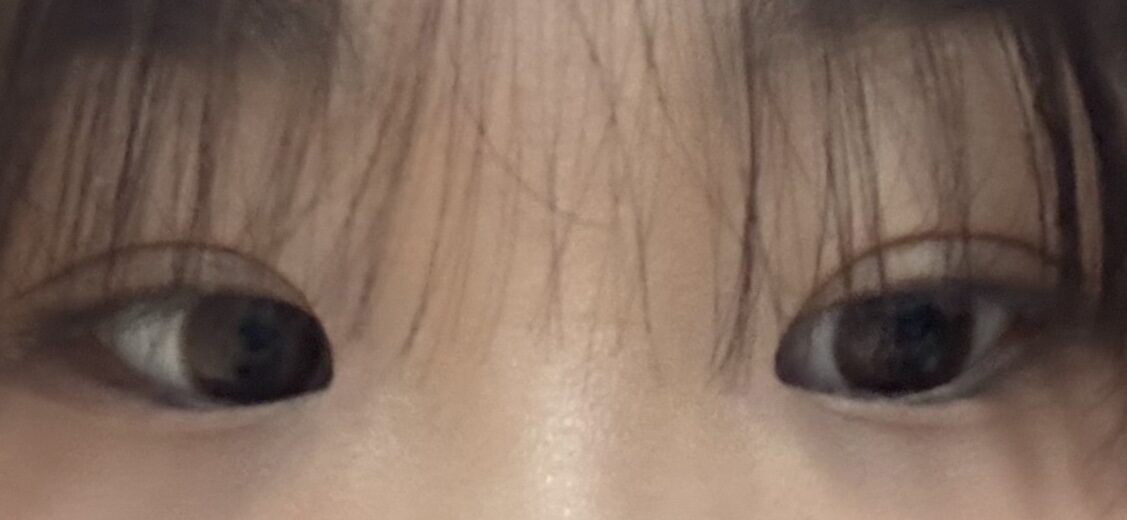 一毫米  金洪振院长