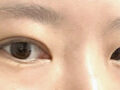บทวิจารณ์ภาพยนตร์ผ่าตัดของผู้กำกับโด ออน-ร็อก แห่งอิลมิริ