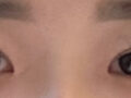 ดร. คิม ฮงจิน จากคลินิก Ilmiri Double Eyelid Buried Suture