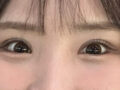 眼科手術のレビュー