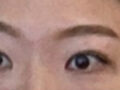 手術後期