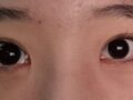 ตาสองชั้นของวัยรุ่น