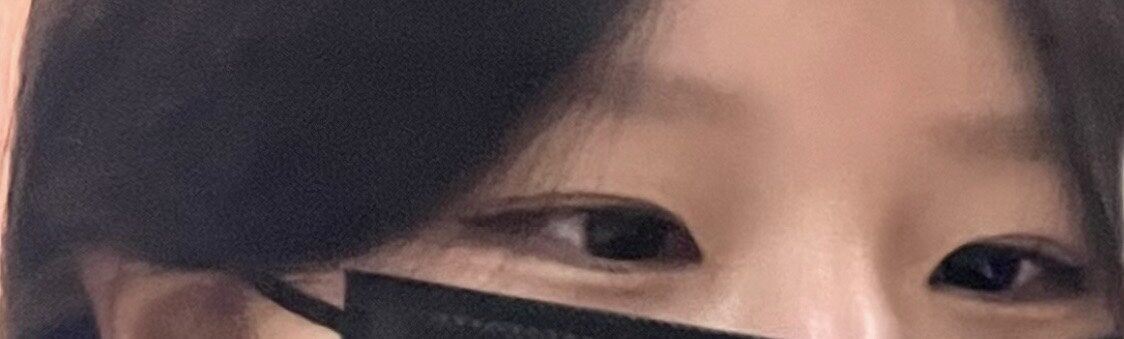 2月3日目手術後のレビュー