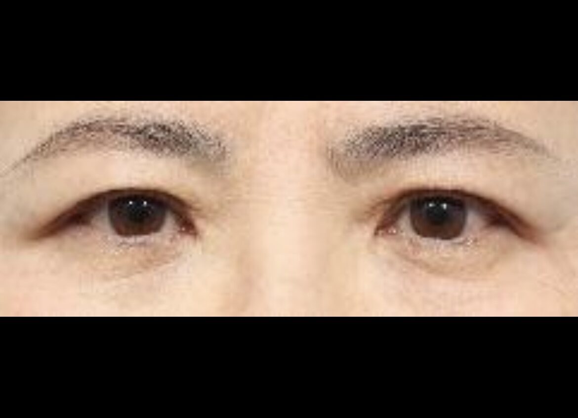 การยกคิ้วของโด ออน-ร็อก ผู้กำกับภาพยนตร์อิลมิริ