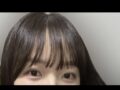 イルミリーキム・ホンジン院長自然癒着レビュー