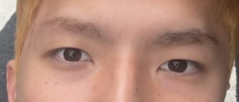 การแก้ไขรูปทรงดวงตาของผู้กำกับโด ออน-ร็อก