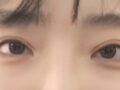 Би анхны давхар зовхины мэс заслаа До захиралтай хамт хийлгэсэн.