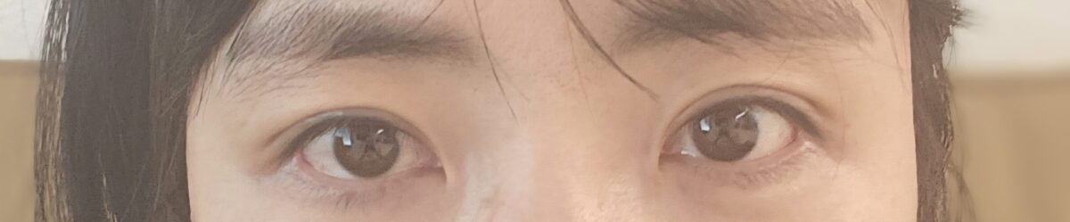 道言録院長切開再手術のレビュー