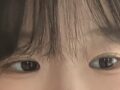 เทคนิคการผ่าตัดตกแต่งหัวตาแบบไม่ต้องกรีดของ ผู้กำกับ โด ออน-ร็อก