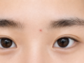 รีวิวการผ่าตัดของ ดร.โด วอน-รก
