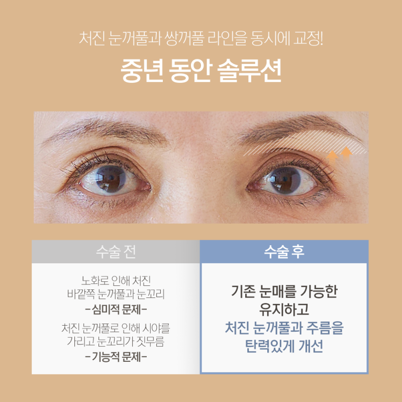 Eyebrow Lift Scars, Side Effects: How to Minimize Them – 1mm Plastic Surgery