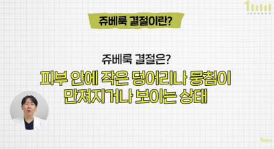 How to Prevent Juvelook Nodules? 1mm Plastic Surgery 사진 3