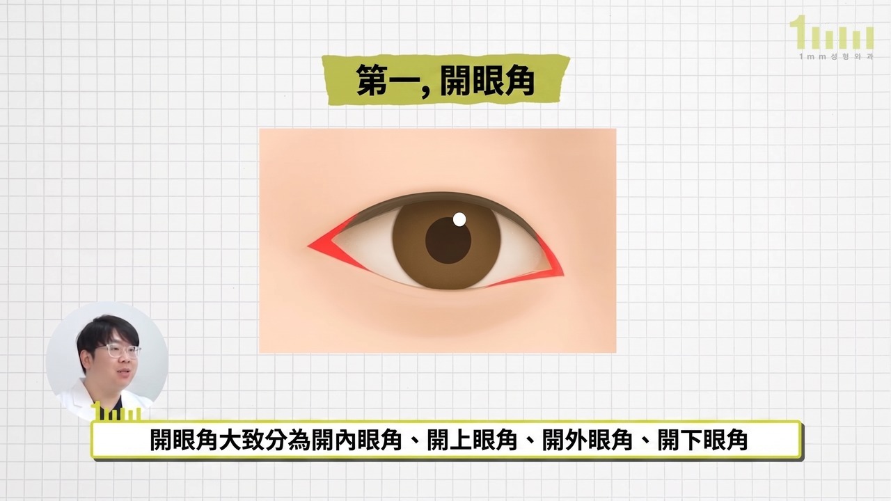 內眼角與眼尾方向以紅色三角形標示的開眼角說明圖，配有影片字幕「開眼角大致分為開內眼角、開上眼角、開外眼角、開下眼角」