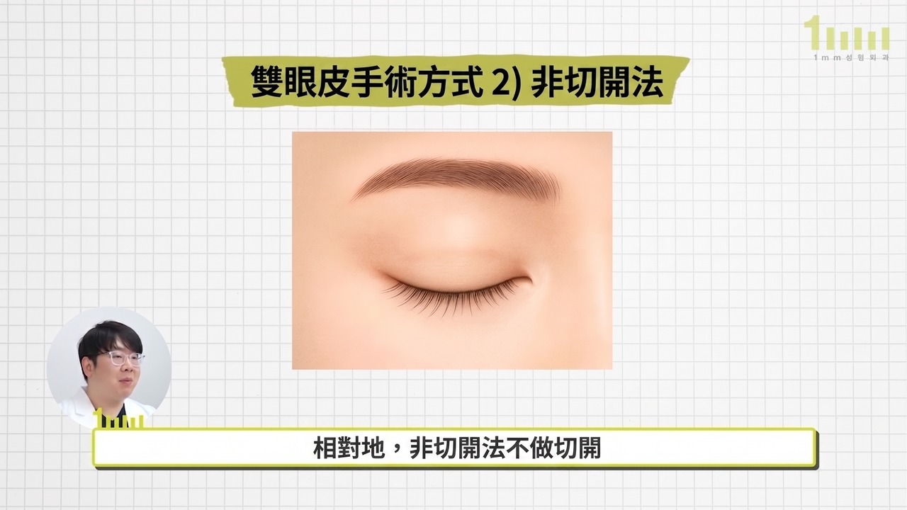沒有切口的閉眼畫面的非切開法說明圖，配有影片字幕「相對地，非切開法不做切開」