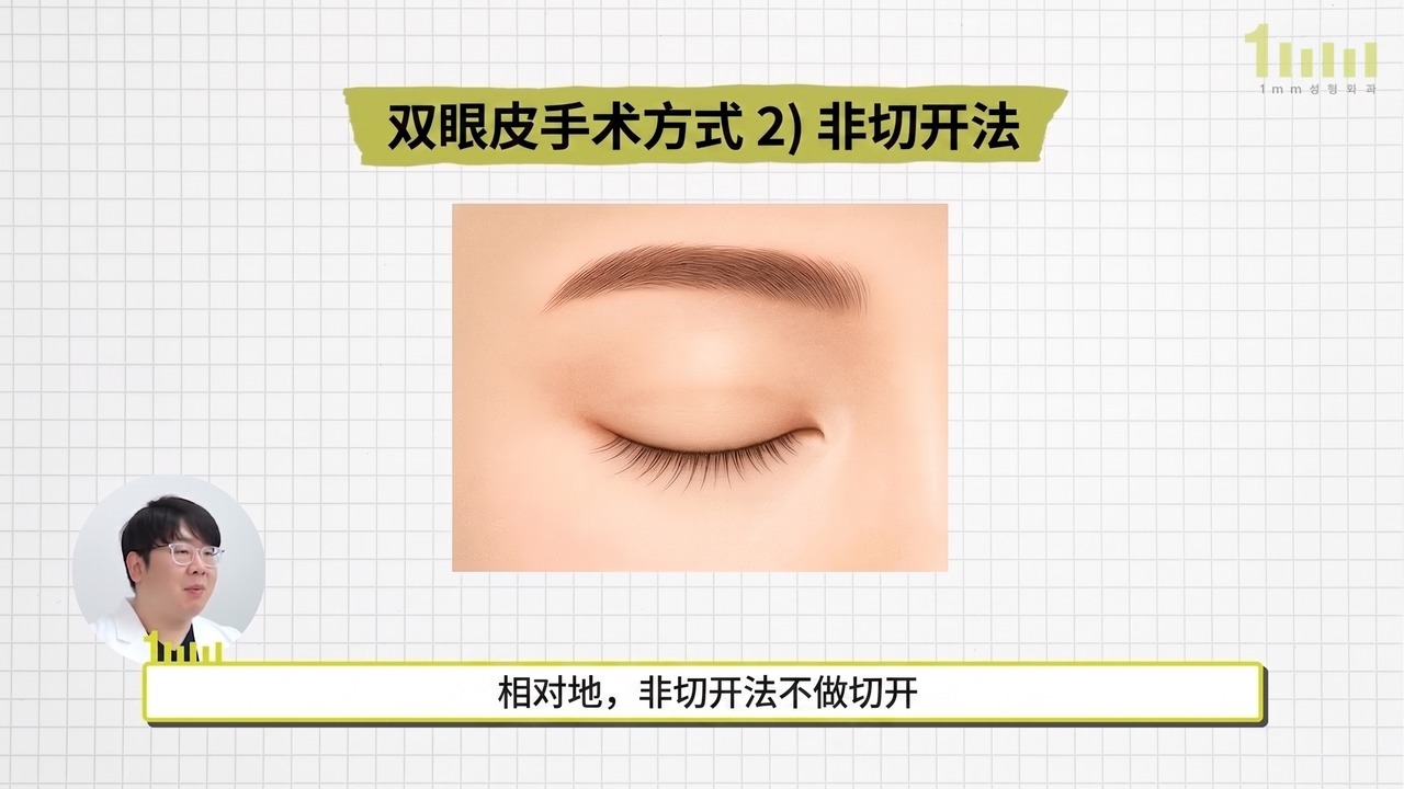 没有切口的闭眼画面的非切开法说明图，配有视频字幕“相对地，非切开法不做切开”