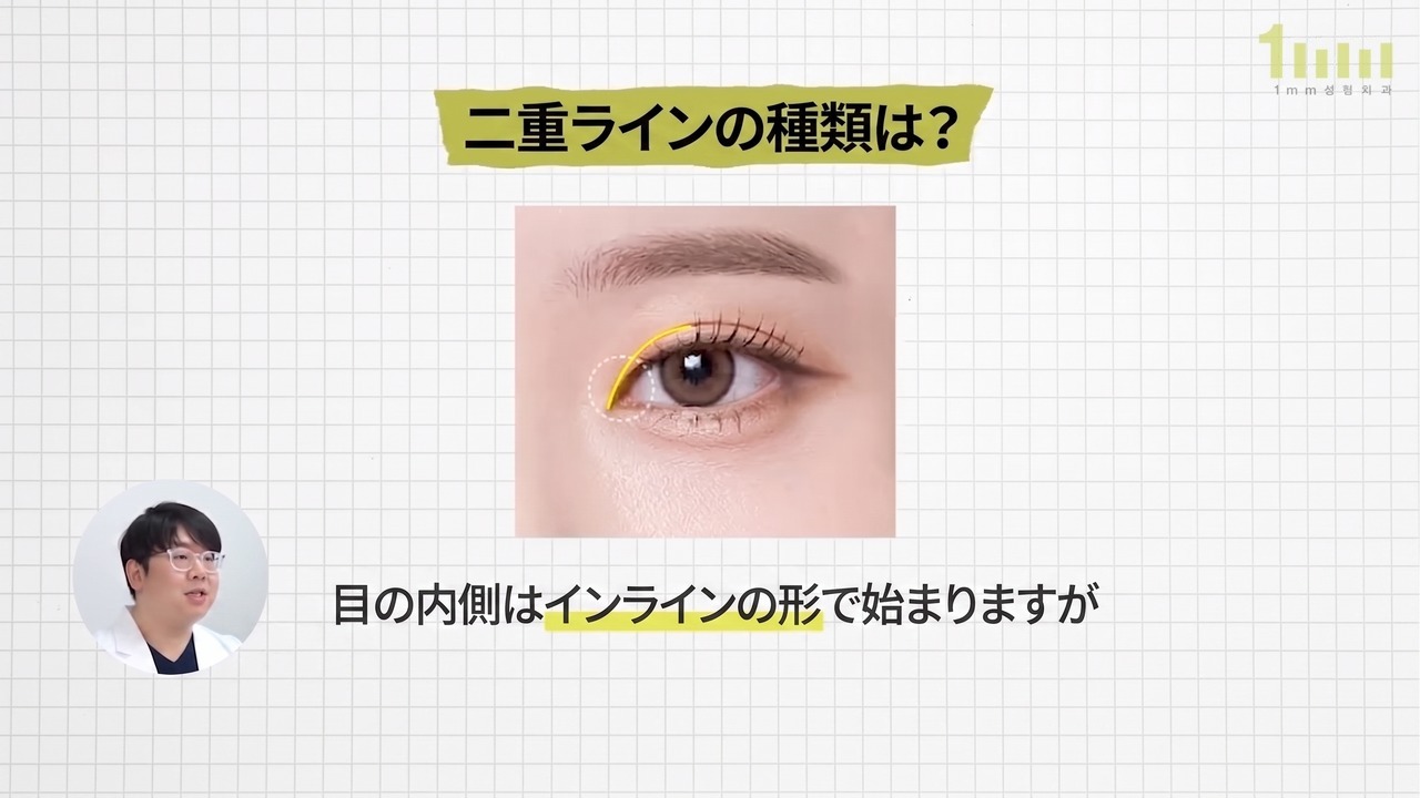 目頭の内側から始まる二重のラインが黄色い線で示された画像と、「目の内側はインラインの形で始まりますが」という動画字幕