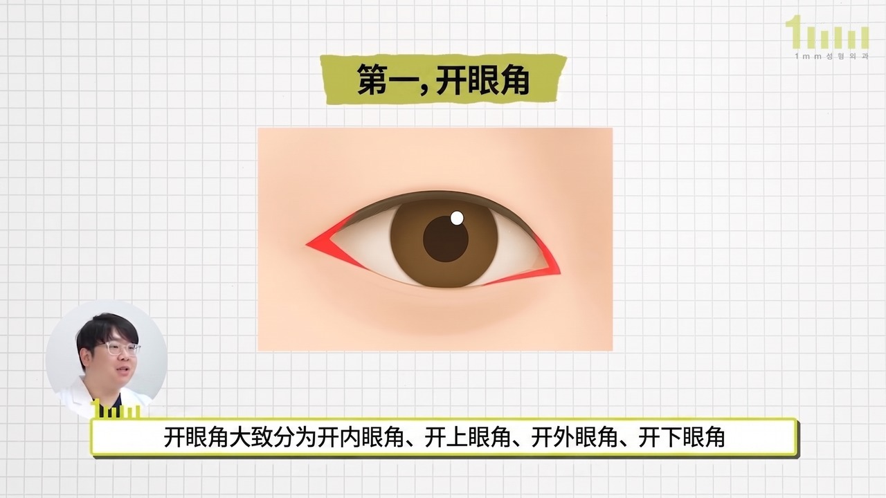内眼角与眼尾方向以红色三角形标示的开眼角说明图，配有视频字幕“开眼角大致分为开内眼角、开上眼角、开外眼角、开下眼角”