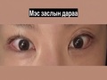 Найруулагч До Эон Рокийн давхар зовхины засвар, нүдний хэлбэрийг засах