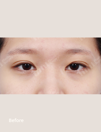 Before