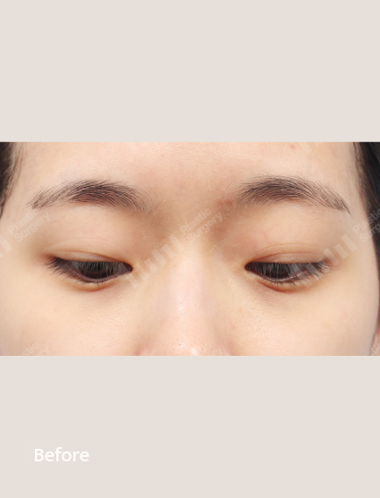 Before