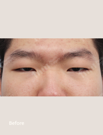 Before