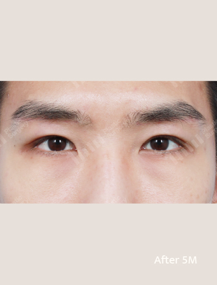 After