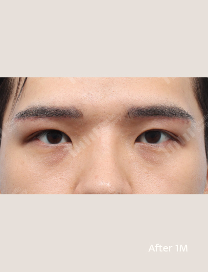 After