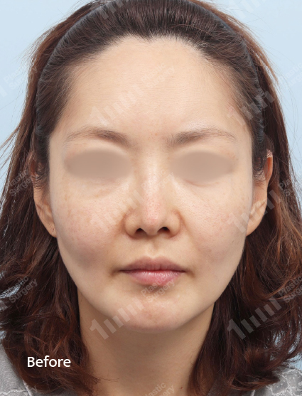 Before