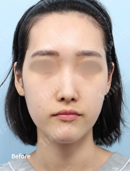 Before