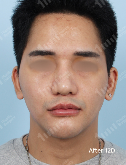 After