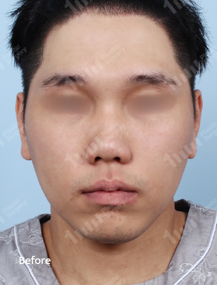 Before