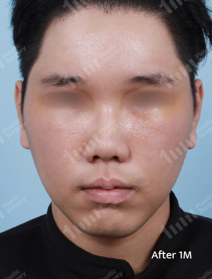 After