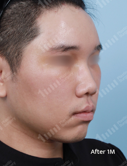 After