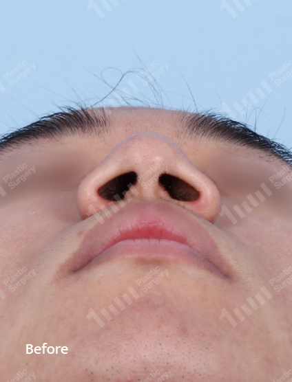 Before