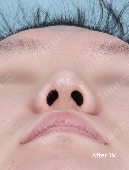 After