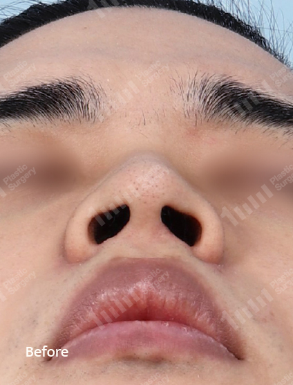 Before