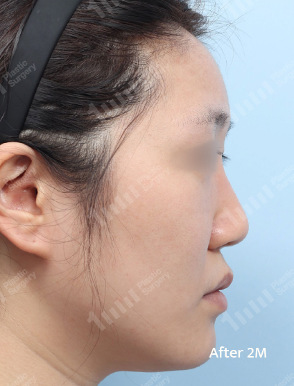 After