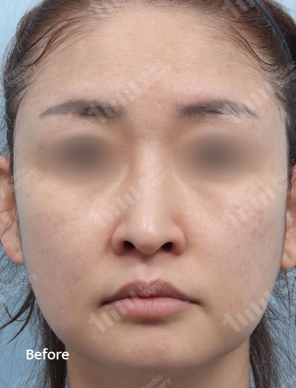 Before