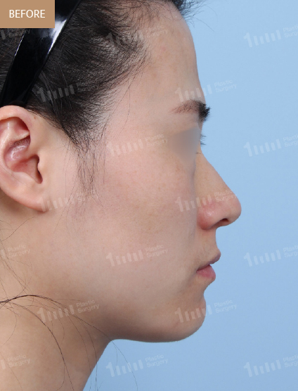 Before