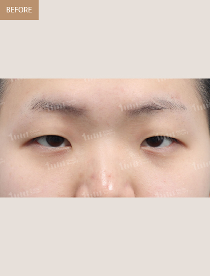 Before