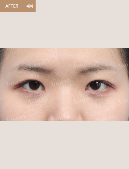 After