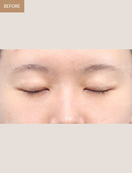 Before