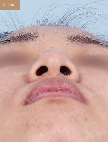 Before