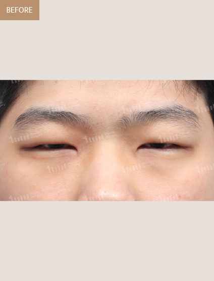 Before