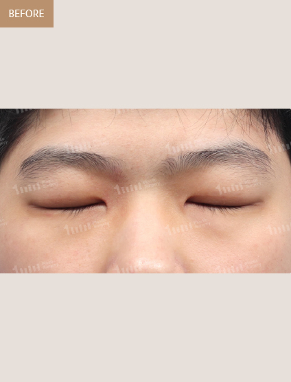 Before