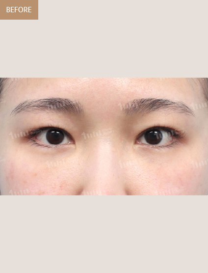 Before