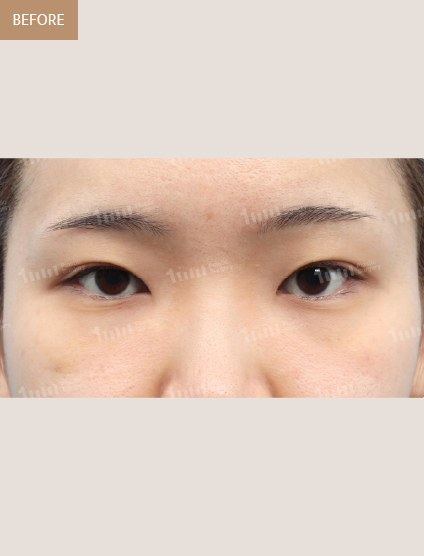 Before