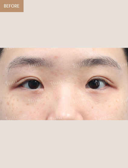Before